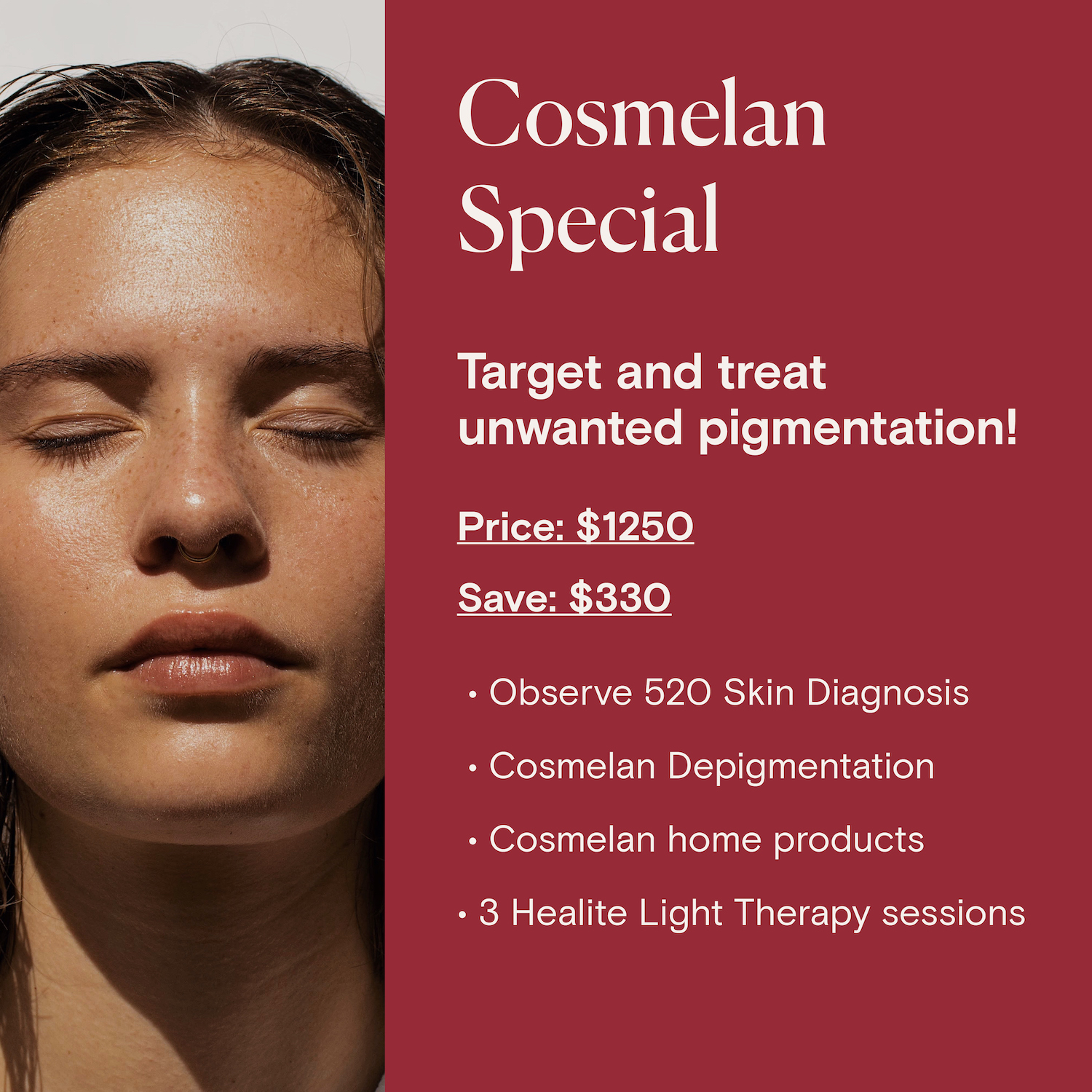 Cosmelan Depigmentation Treatment Package The Brow Skin Studio